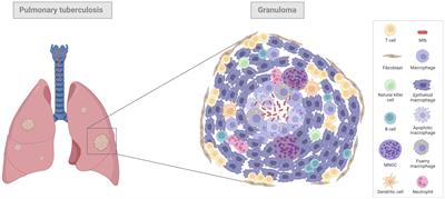 Comparative pathology of experimental pulmonary tuberculosis in animal models